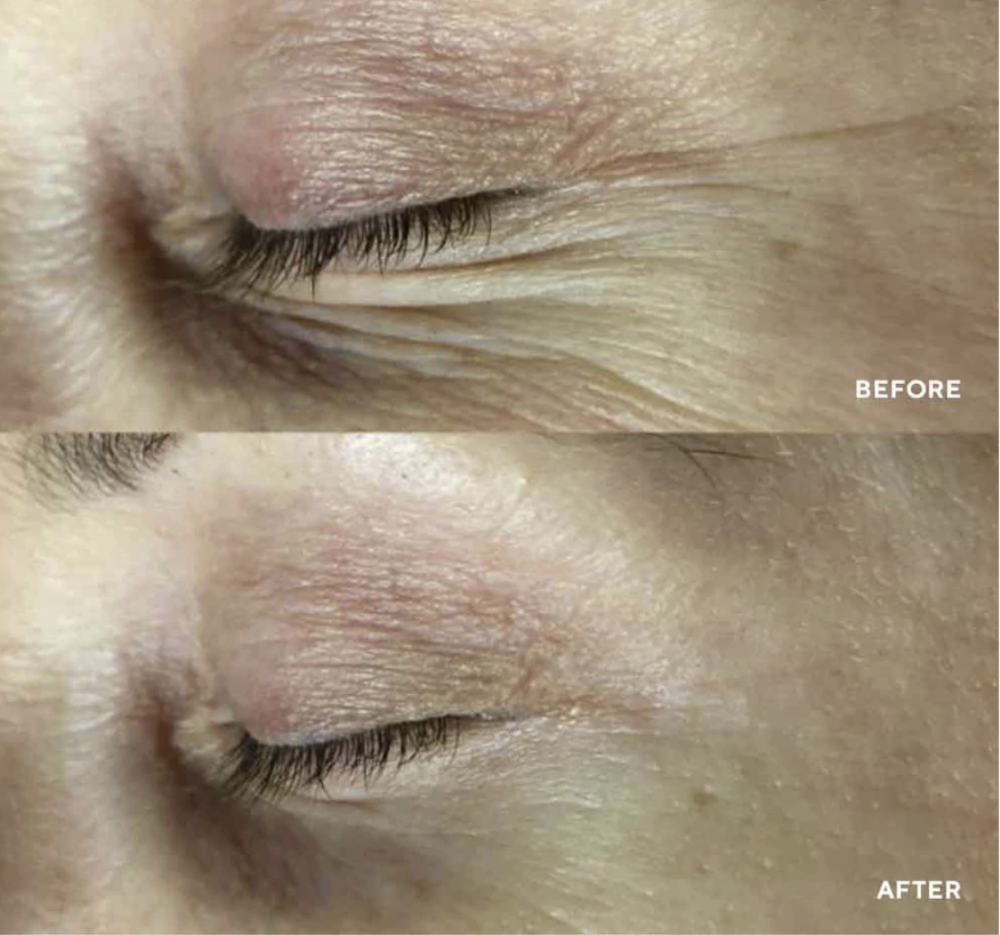 Darček Maska na oči Polypeptide Eye Collagel 1 ks<br>Kolagénová a hydratačná očná maska s účinnosťou až na bunkovej úrovni DNA