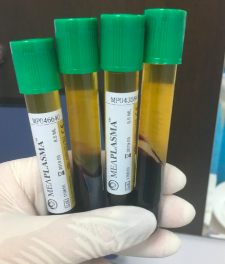 CENTRIFÚGA PRP<br>Centrifuga na získanie krvnej plazmy PRGF