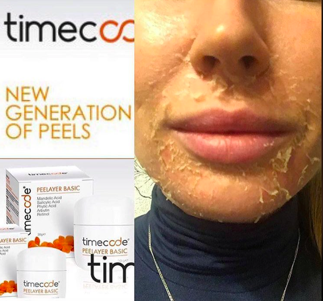 RETINOL PEELING<br>Teória a prax