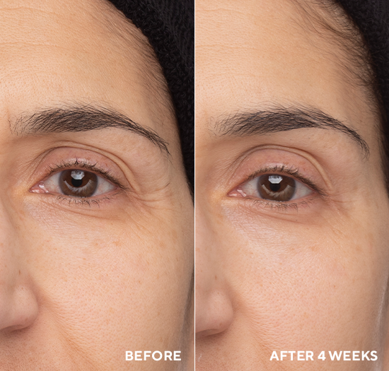 Očný krém s retinolom<br>Retinol Eye Renewal<br>Liftingový krém. Spevnenie a rozjasnenie. Obsahuje patentovaný CellRenew-16 a Tri-Retinol