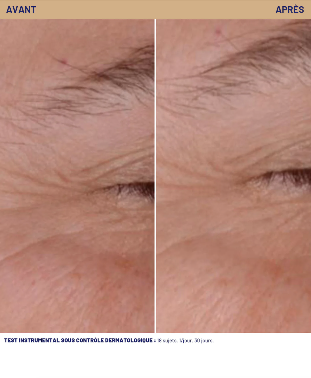 SOSKIN GLYCO C PIGMENT-WRINKLE CORRECTIVE CARE <br><br>EXP 04/26 zľava 80% 
Antipigmentačný, protivráskový peelingový nočný krém 30 ml.