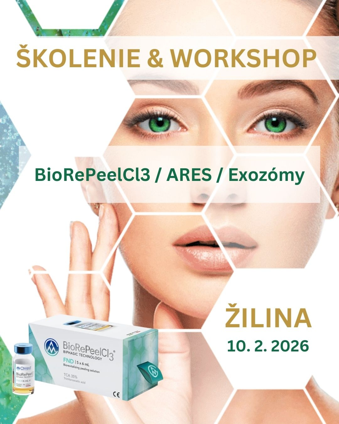 WORKSHOP BIOREPEELCL3 ARES EXOZÓMY 
10. február Školenie BioRePeelCl3, Ares, Exozómy