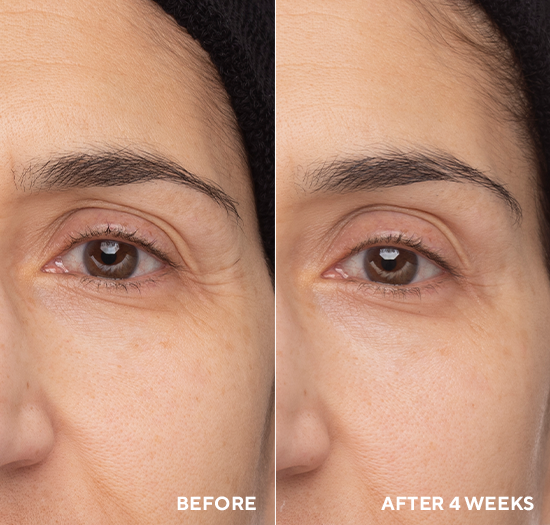 Retinol Eye Renewal NEW