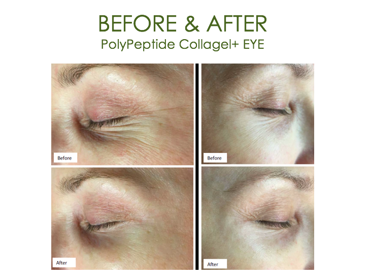 PolyPeptide Collagel Eye 24St.